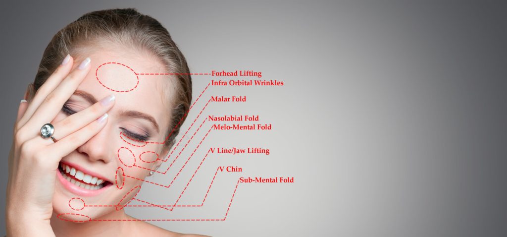PDO Threads Aka Polydioxanone at Aromas MedSpa