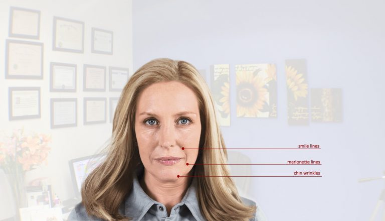 Sculptra Aesthetic FDA Approved at Aromas MedSpa